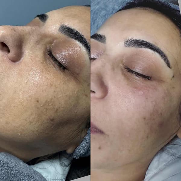Tuğba Beauty Therapy - 13. Fotoğraf