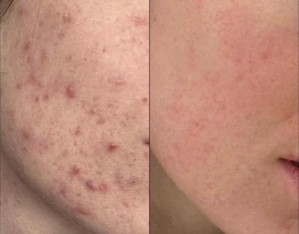 Tuğba Beauty Therapy - 6. Fotoğraf Tuğba Beauty Therapy - 6. Fotoğraf