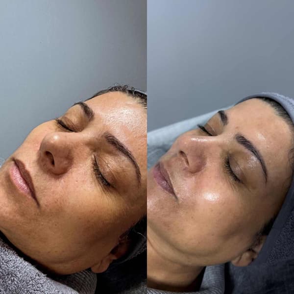Tuğba Beauty Therapy - 21. Fotoğraf