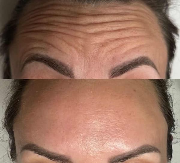 Tuğba Beauty Therapy - 9. Fotoğraf