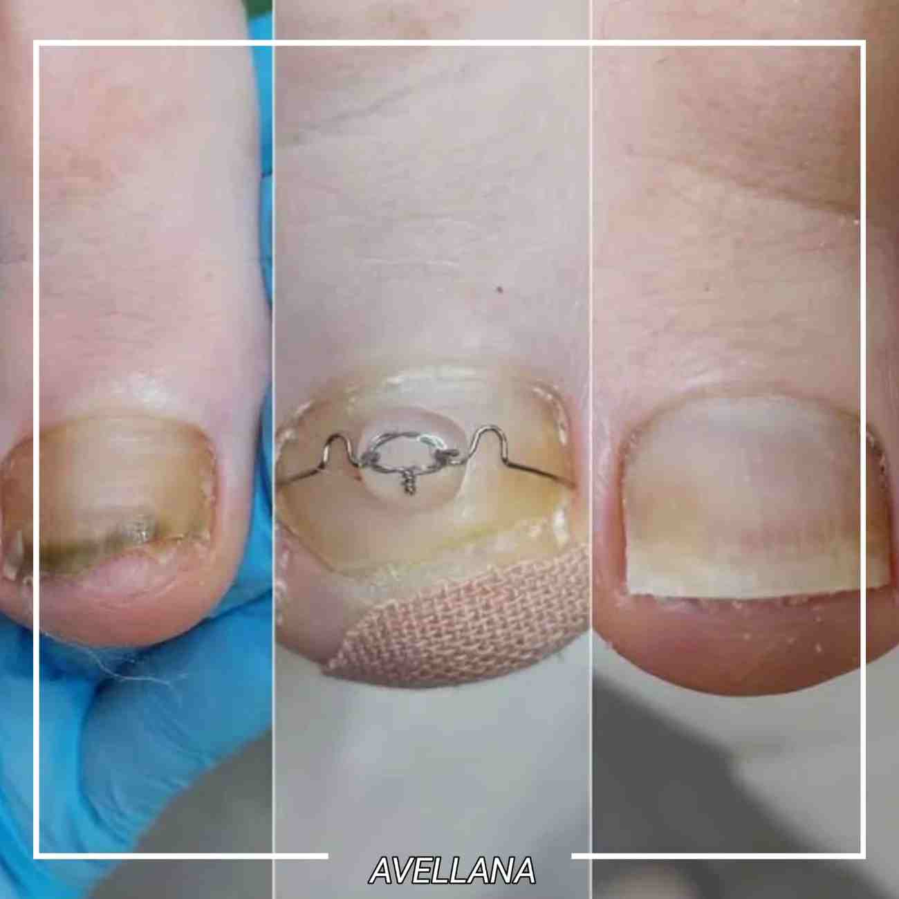 Avellena Güzellik Kulübü