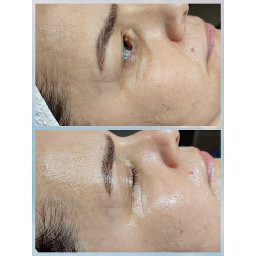 Merve Şensoy Güzellik Merkezi - 4. Fotoğraf Merve Şensoy Güzellik Merkezi - 4. Fotoğraf