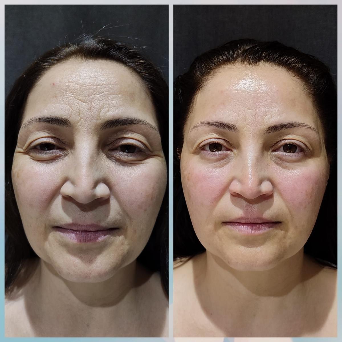 Merve Şensoy Güzellik Merkezi - Aydınlıkevler Ağda - 2. Fotoğraf