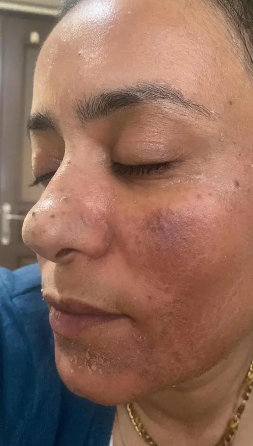 Sıla Yıldız Beauty - 3. Fotoğraf Sıla Yıldız Beauty - 3. Fotoğraf