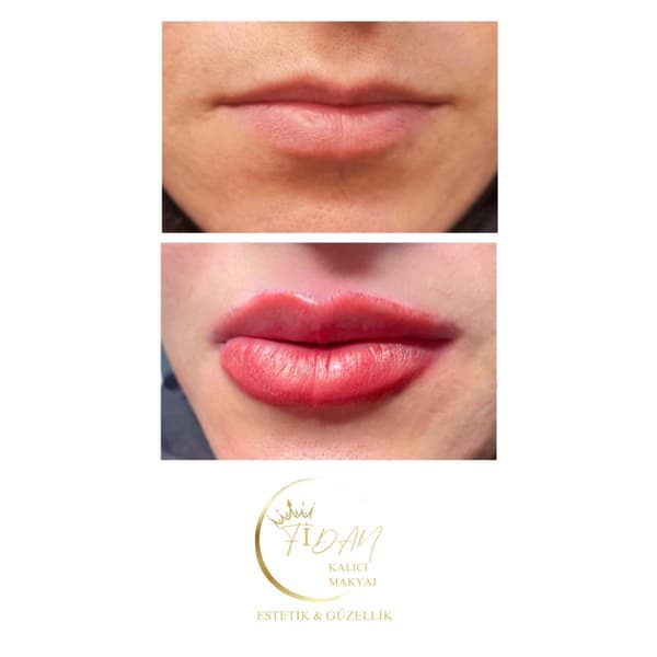 Fidan Kalıcı Makyaj Estetik Güzellik - 10. Fotoğraf Fidan Kalıcı Makyaj Estetik Güzellik - 10. Fotoğraf