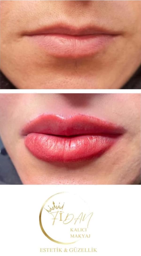 Fidan Kalıcı Makyaj Estetik Güzellik - 13. Fotoğraf