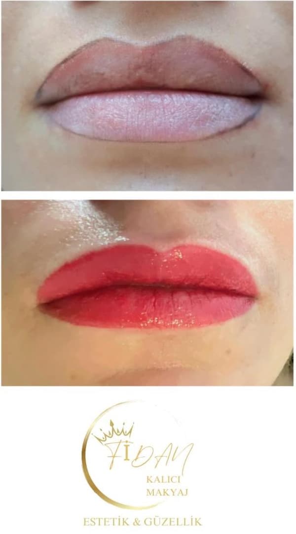 Fidan Kalıcı Makyaj Estetik Güzellik - 12. Fotoğraf