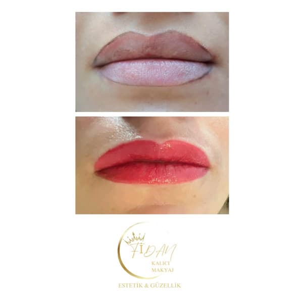 Fidan Kalıcı Makyaj Estetik Güzellik - 4. Fotoğraf Fidan Kalıcı Makyaj Estetik Güzellik - 4. Fotoğraf