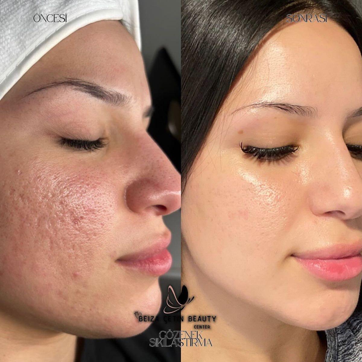 Beiza Çetin Beauty Center - 2. Fotoğraf