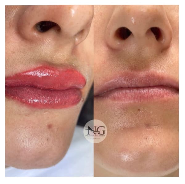 Nergis Epilasyon ve Güzellik - 14. Fotoğraf Nergis Epilasyon ve Güzellik - 14. Fotoğraf