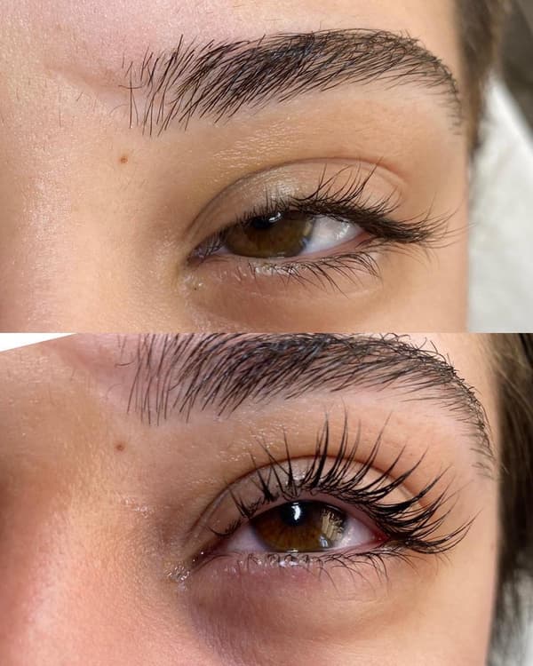 Nergis Epilasyon ve Güzellik - 15. Fotoğraf Nergis Epilasyon ve Güzellik - 15. Fotoğraf