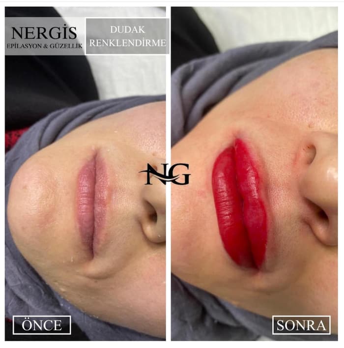 Nergis Epilasyon ve Güzellik - 2. Fotoğraf