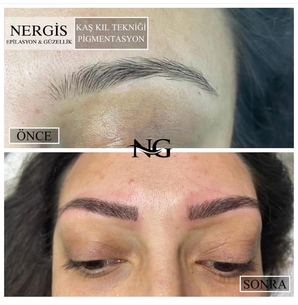 Nergis Epilasyon ve Güzellik - 10. Fotoğraf