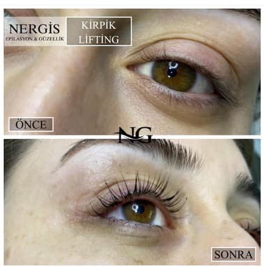 Nergis Epilasyon ve Güzellik