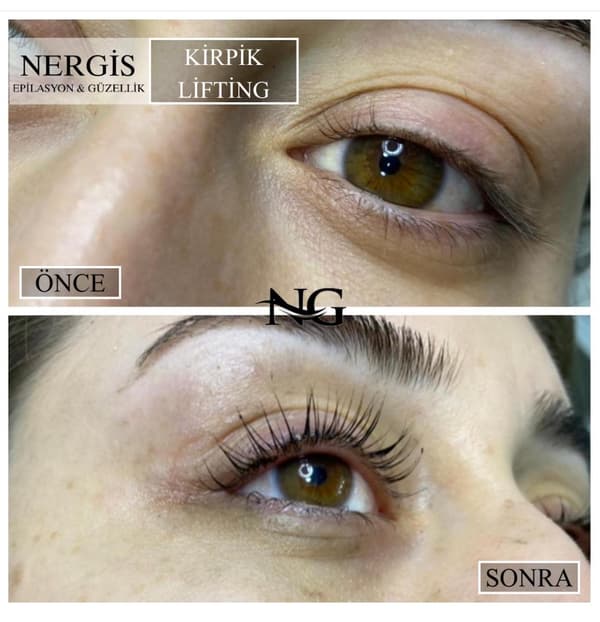 Nergis Epilasyon ve Güzellik - 1. Fotoğraf Nergis Epilasyon ve Güzellik - 1. Fotoğraf