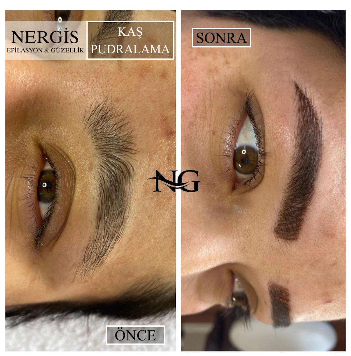 Nergis Epilasyon ve Güzellik