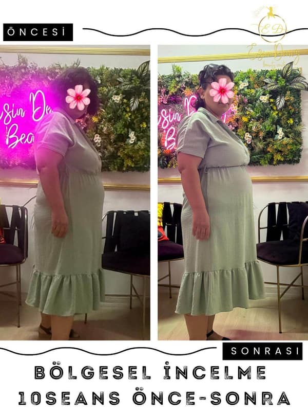 Esin Deniz Beauty  - 11. Fotoğraf